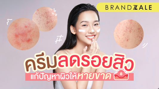 ครีมลดรอยสิวกับรีวิว 5 เรื่องน่าสนใจ เพื่อแก้ปัญหาผิวให้หายขาด